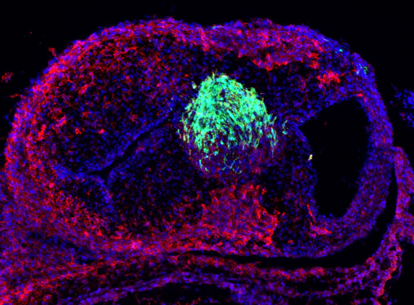 Understanding Congenital Heart Defects, One Chicken at a Time